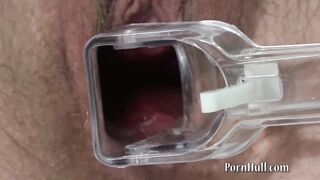 Teen Girl 18+ with Hairy Pussy Masturbates and Shows her Vagina using a Genecological Speculum